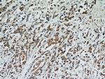 STAT2 Antibody in Immunohistochemistry (Paraffin) (IHC (P))