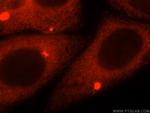 AMFR Antibody in Immunocytochemistry (ICC/IF)