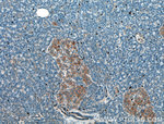 AMFR Antibody in Immunohistochemistry (Paraffin) (IHC (P))