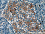 AMFR Antibody in Immunohistochemistry (Paraffin) (IHC (P))
