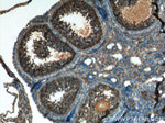 AMFR Antibody in Immunohistochemistry (Paraffin) (IHC (P))