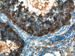 AMFR Antibody in Immunohistochemistry (Paraffin) (IHC (P))