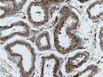 AMFR Antibody in Immunohistochemistry (Paraffin) (IHC (P))