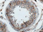 AMFR Antibody in Immunohistochemistry (Paraffin) (IHC (P))