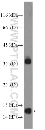 POLR1D Antibody in Western Blot (WB)