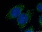 RPS13 Antibody in Immunocytochemistry (ICC/IF)