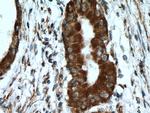 RPS13 Antibody in Immunohistochemistry (Paraffin) (IHC (P))