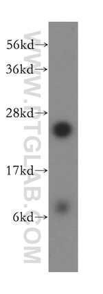 RPL10A Antibody in Western Blot (WB)