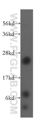 RPL10A Antibody in Western Blot (WB)