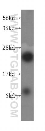 RPL10A Antibody in Western Blot (WB)