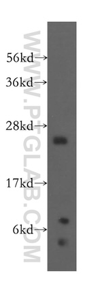 RPL10A Antibody in Western Blot (WB)