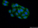 CRK Antibody in Immunocytochemistry (ICC/IF)