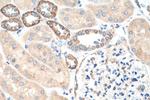 CKAP4 Antibody in Immunohistochemistry (Paraffin) (IHC (P))