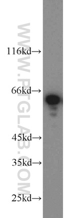 CKAP4 Antibody in Western Blot (WB)