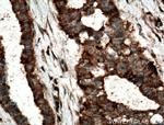 TOMM6 Antibody in Immunohistochemistry (Paraffin) (IHC (P))