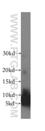 TOMM6 Antibody in Western Blot (WB)