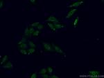 ALY Antibody in Immunocytochemistry (ICC/IF)