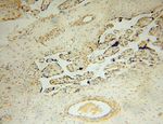 PARP11 Antibody in Immunohistochemistry (Paraffin) (IHC (P))