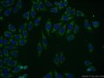 KLHL14 Antibody in Immunocytochemistry (ICC/IF)