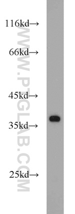 KLHL14 Antibody in Western Blot (WB)