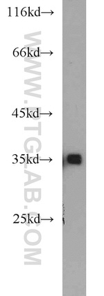 KLHL14 Antibody in Western Blot (WB)