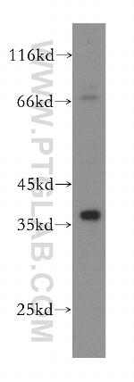 KLHL14 Antibody in Western Blot (WB)