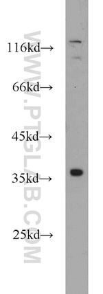 KLHL14 Antibody in Western Blot (WB)