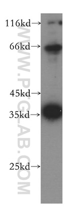 KLHL14 Antibody in Western Blot (WB)
