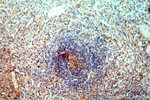 CA13 Antibody in Immunohistochemistry (Paraffin) (IHC (P))