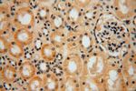 CA13 Antibody in Immunohistochemistry (Paraffin) (IHC (P))