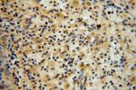 CA13 Antibody in Immunohistochemistry (Paraffin) (IHC (P))