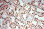 CA13 Antibody in Immunohistochemistry (Paraffin) (IHC (P))