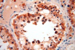 CA13 Antibody in Immunohistochemistry (Paraffin) (IHC (P))