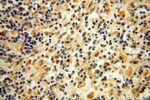 CA13 Antibody in Immunohistochemistry (Paraffin) (IHC (P))