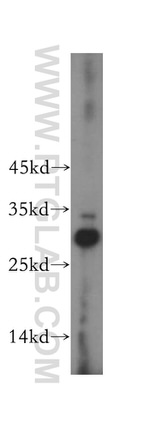 CA13 Antibody in Western Blot (WB)