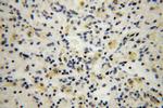 ARHGAP4 Antibody in Immunohistochemistry (Paraffin) (IHC (P))