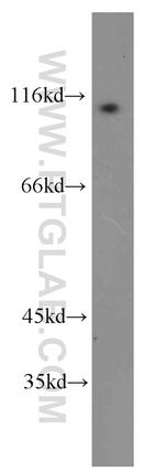 ARHGAP4 Antibody in Western Blot (WB)