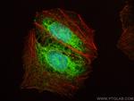 NAA40 Antibody in Immunocytochemistry (ICC/IF)