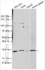 NAA40 Antibody in Western Blot (WB)