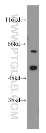 CYP20A1 Antibody in Western Blot (WB)