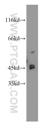 CYP20A1 Antibody in Western Blot (WB)