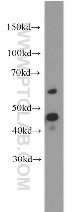 CYP20A1 Antibody in Western Blot (WB)