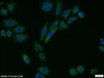 MTH1 Antibody in Immunocytochemistry (ICC/IF)