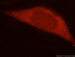 RPL7L1 Antibody in Immunocytochemistry (ICC/IF)