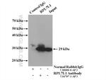 RPL7L1 Antibody in Immunoprecipitation (IP)