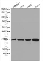 RPL7L1 Antibody in Western Blot (WB)