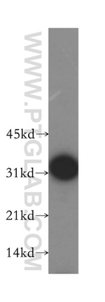 RPL7L1 Antibody in Western Blot (WB)