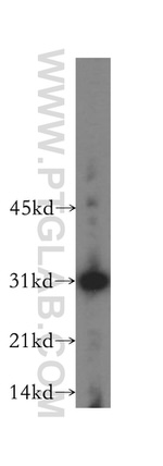 RPL7L1 Antibody in Western Blot (WB)