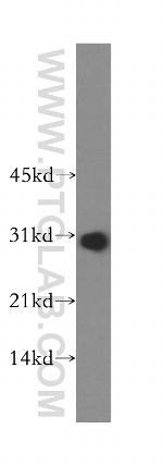 RPL7L1 Antibody in Western Blot (WB)