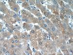 HSPC159 Antibody in Immunohistochemistry (Paraffin) (IHC (P))
